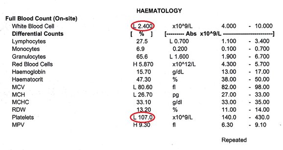 Platelet level normal Platelets: High