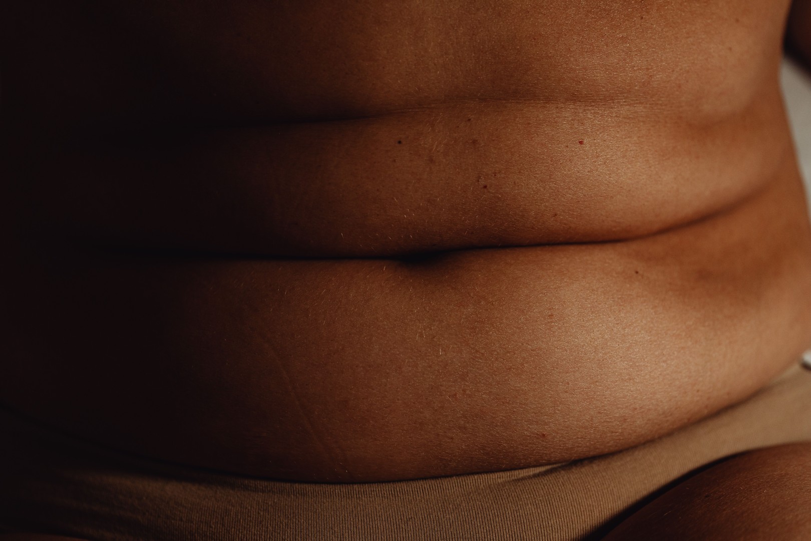 Liposuction in Singapore: What It Can and Cannot Fix